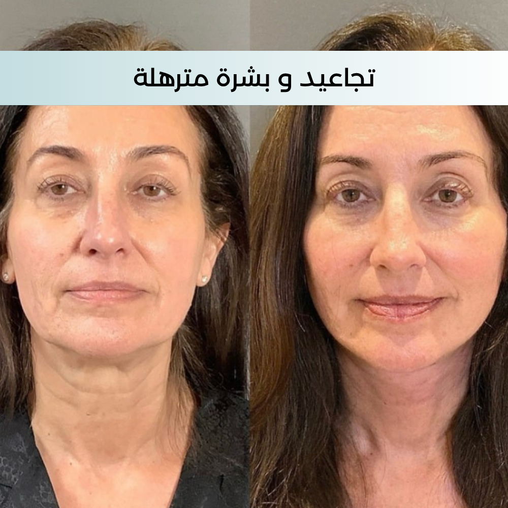 Crème anti-âge Revita Pro