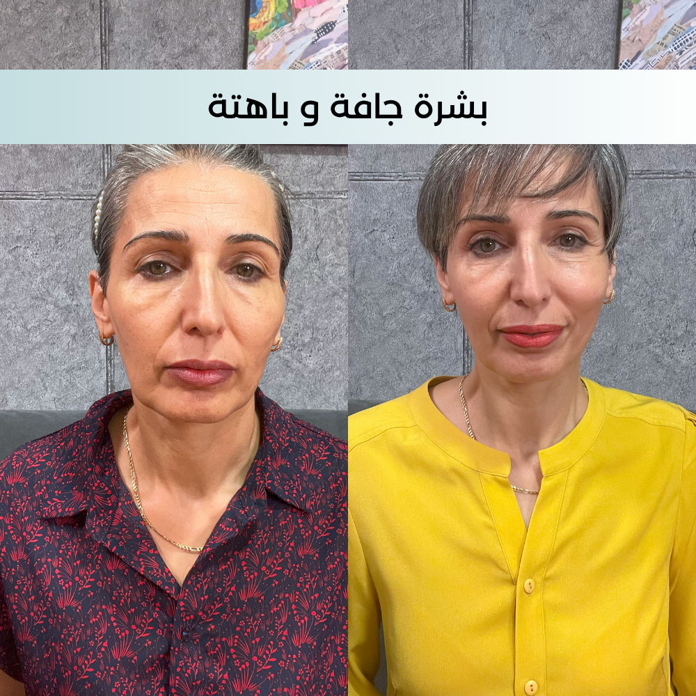 Crème anti-âge Revita Pro