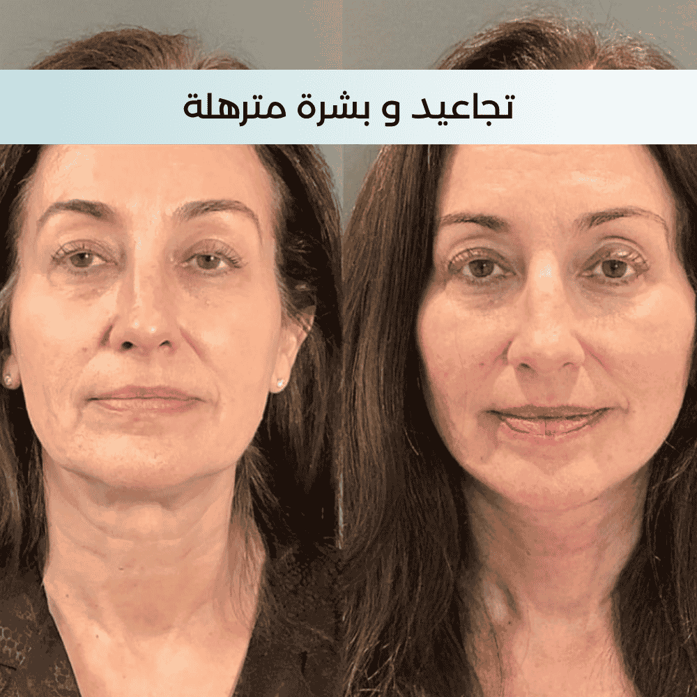 Crème anti-âge Revita Pro